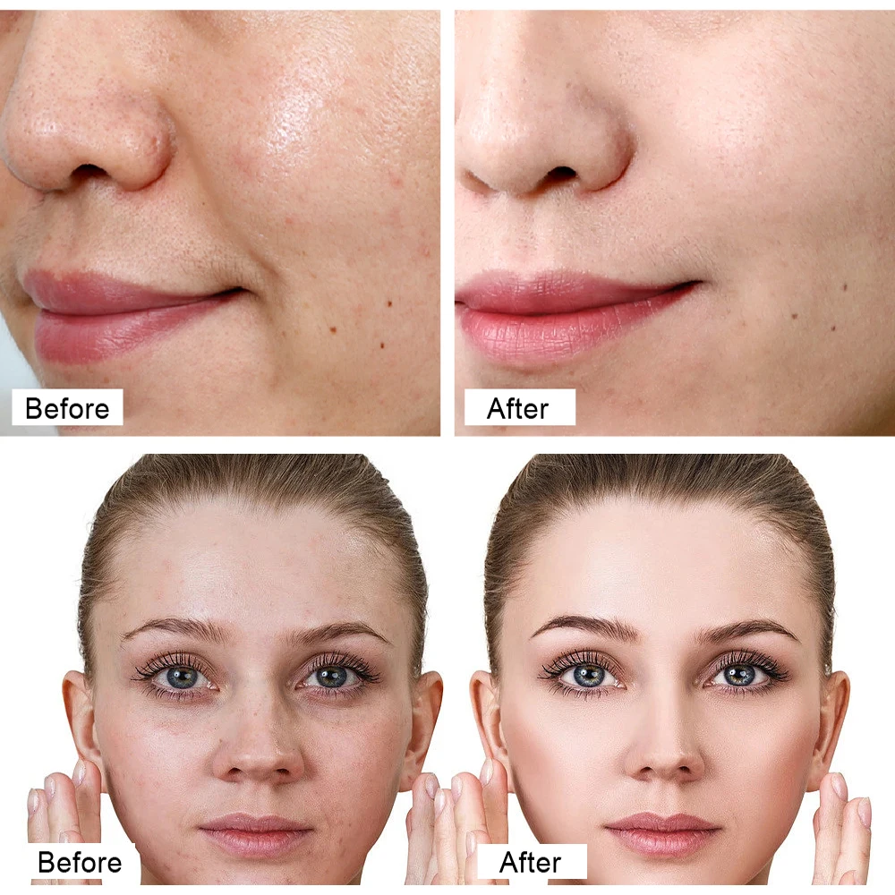 Creme Facial LG Ramér Retinol Active™