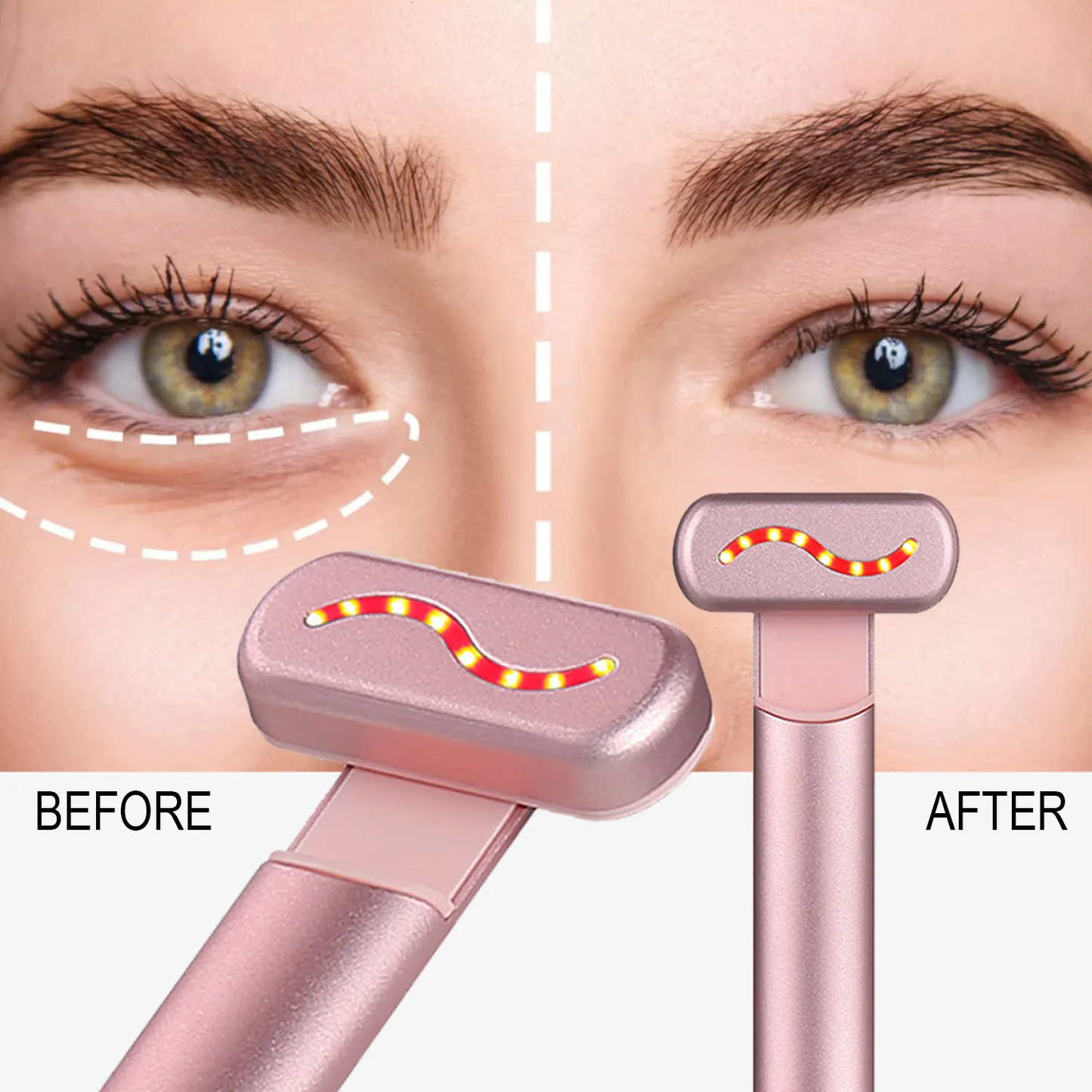 Aparelho de Esmaciamento Facial GlowSkin™